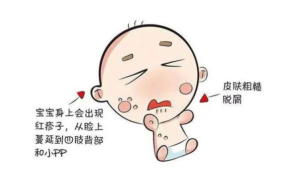 新手爸妈必看！婴儿湿疹全攻略